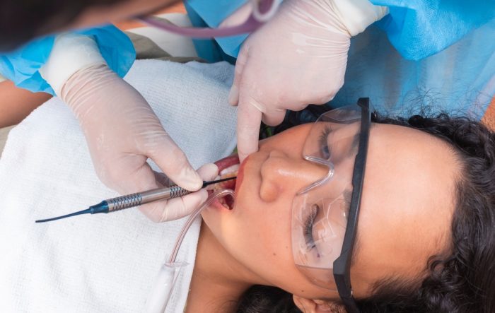 A close-up of a woman's bright smile, showcasing her white teeth and joyful expression.