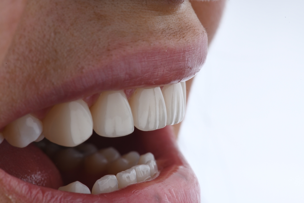 A close-up of a woman's bright smile, showcasing her white teeth and joyful expression.