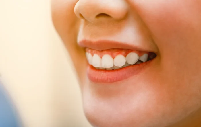 Can You Go Back to Normal Teeth After Composite Bonding?